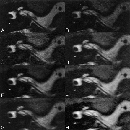 Fig 3.