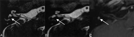 Fig 5.