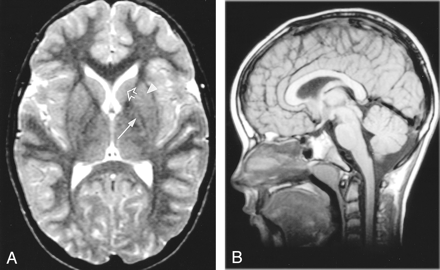 Fig 1.