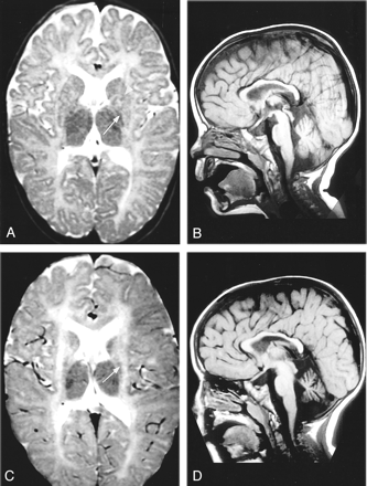Fig 2.