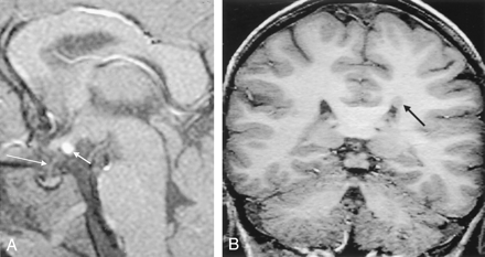 Fig 1.