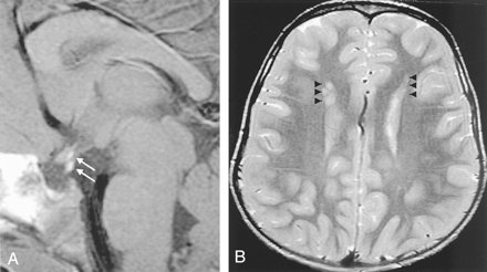 Fig 2.