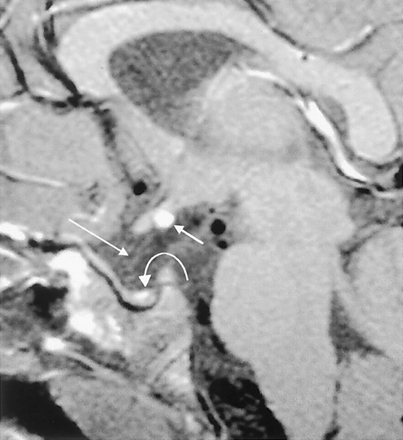 Fig 3.