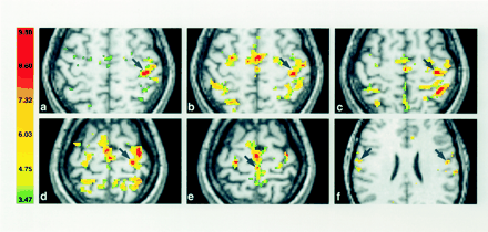 Fig 1.