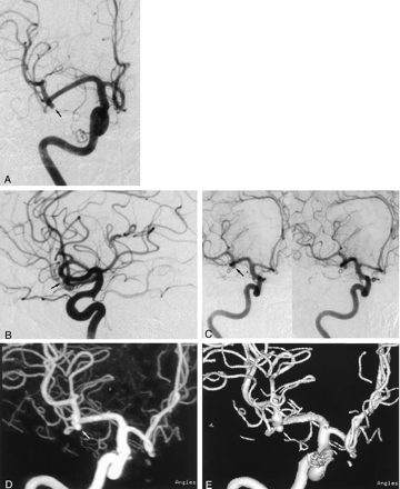 Fig 2.