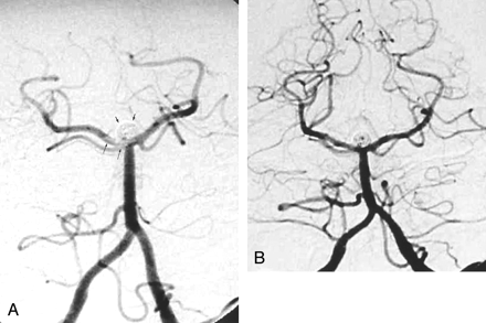 Fig 2.