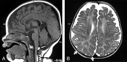 Fig 1.