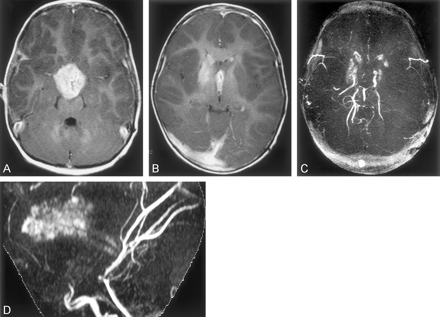 Fig 1.