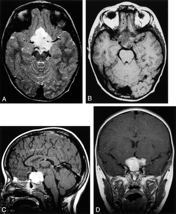 Fig 2.