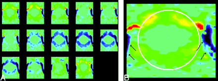 Fig 1.