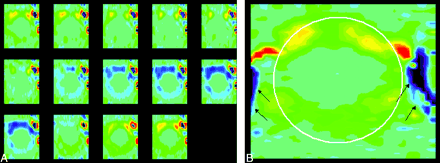 Fig 4.