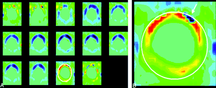 Fig 5.
