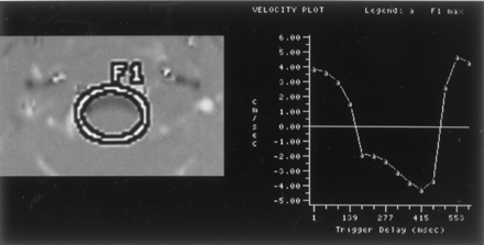 Fig 6.