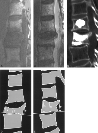Fig 2.