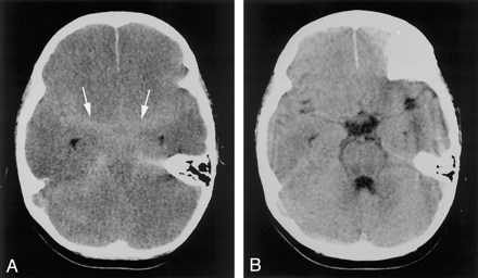 Fig 2.