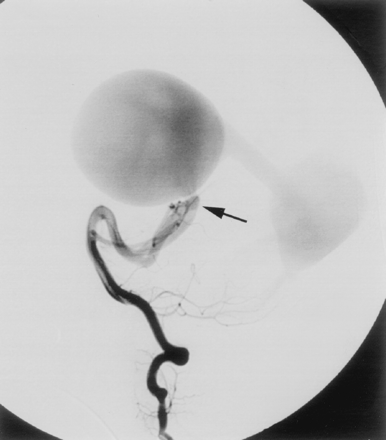 Fig 2.