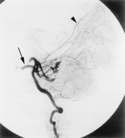 Fig 7.