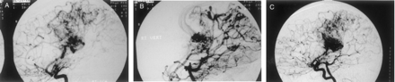 Fig 1.