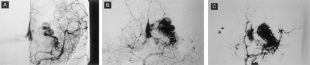 Fig 3.
