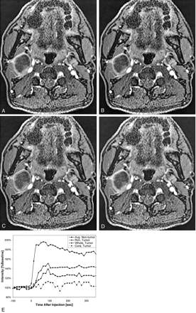 Fig 4.