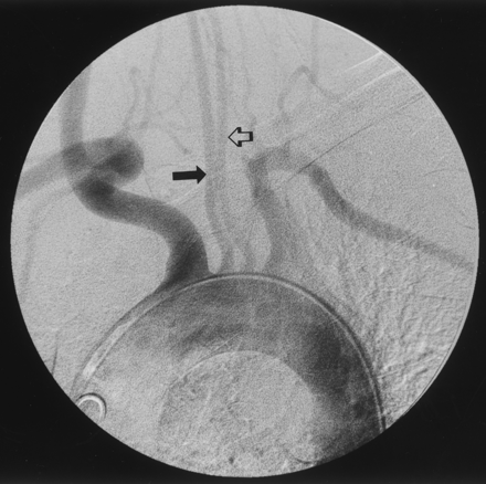Fig 1.