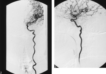 Fig 2.