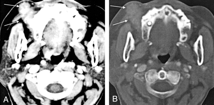 Fig 2.