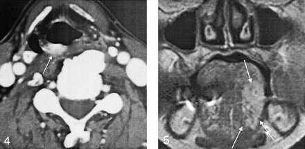 Fig 5.