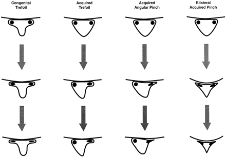 Fig 1.