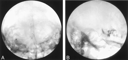 Fig 3.