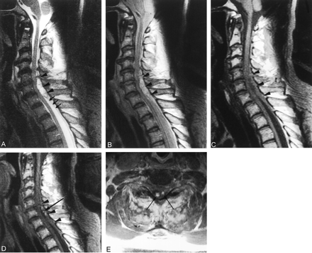 Fig 2.
