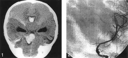 Fig 2.