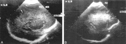 Fig 1.