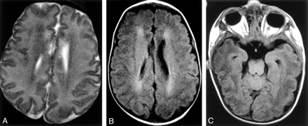 Fig 2.