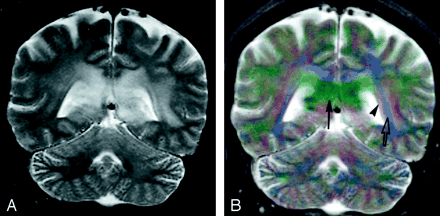 Fig 6.