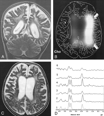 Fig 5.
