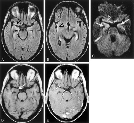 Fig 2.