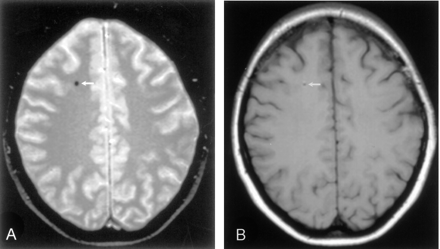 Fig 1.