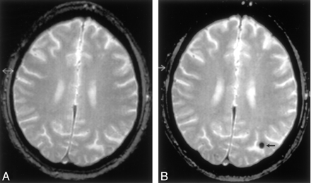 Fig 2.