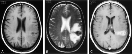 Fig 2.