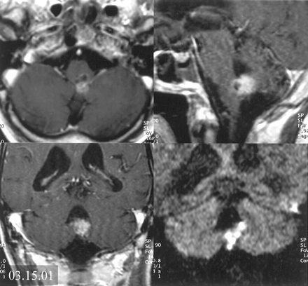 Fig 2.