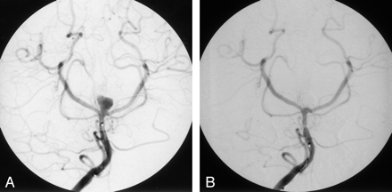 Fig 2.