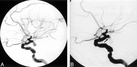 Fig 4.