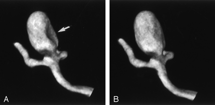 Fig 3.