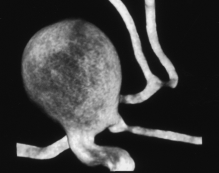 Fig 5.