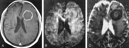 Fig 3.