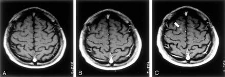 Fig 1.