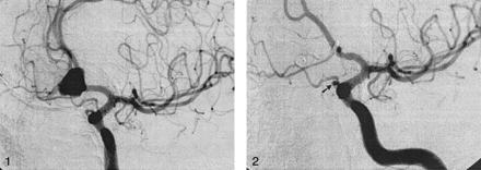 Fig 2.