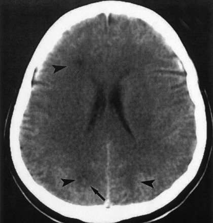 Fig 1.