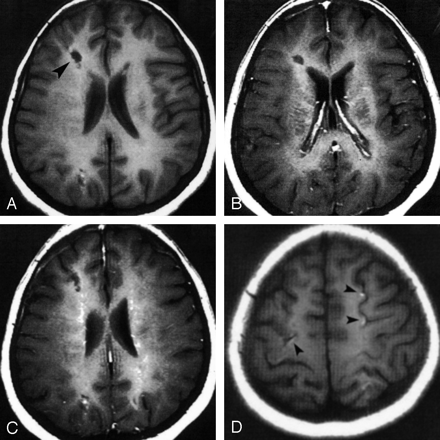 Fig 3.